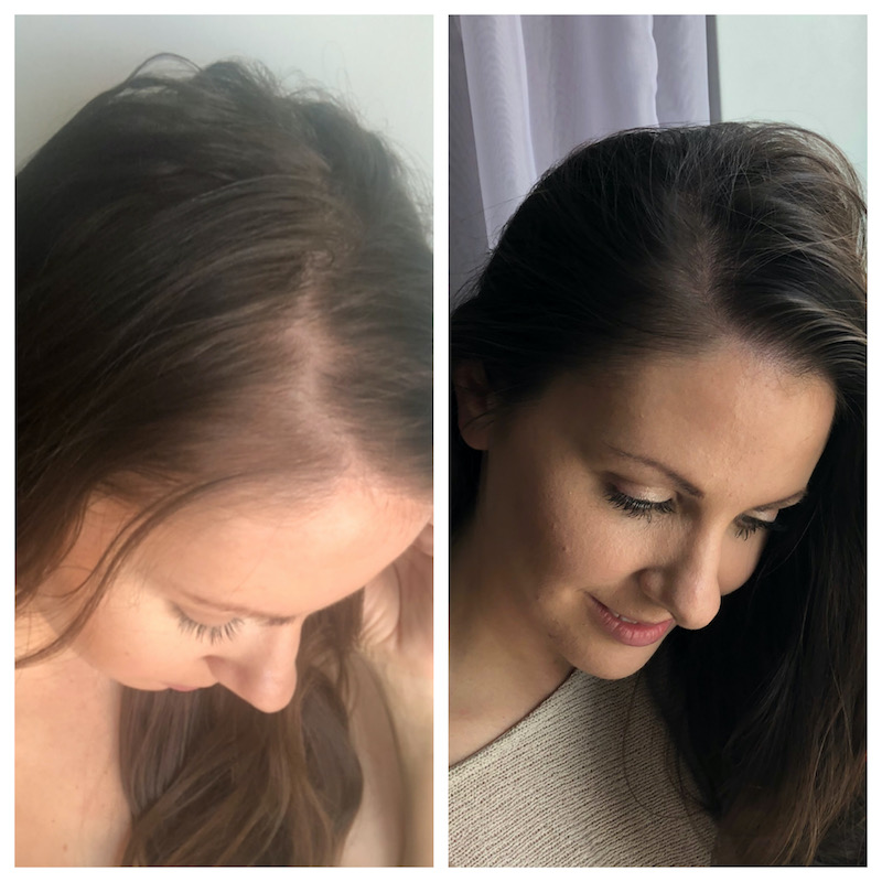 My Honest Experience With MONAT Hair Products - Detox On The Rocks